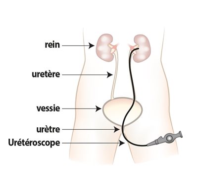 Système urinaire