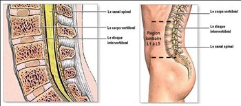 Colonne vertébrale lombaire