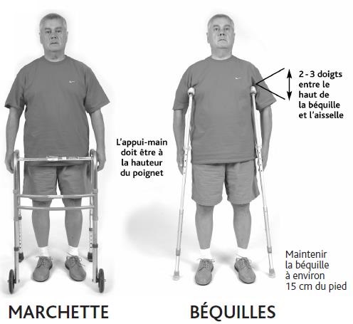 Prothèse totale du genou (PTG) | CHU de Québec-Université Laval