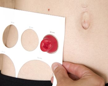 Feuille pour la mesure de la stomie, il y a des cercles de différentes grosseur avec la dimensions.