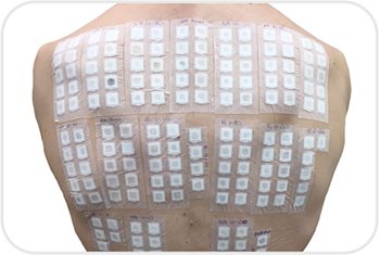 On voit le dos d'une personne qui est couvert entièrement de petits collants carrés.