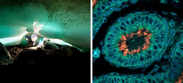 Les deux photos provenant de chercheurs du CRCHU.