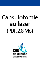 Image couverture Capsulotomie au laser.