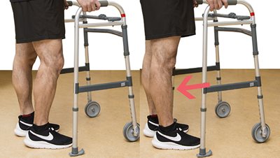 Démonstration de l'exercice 5, sur la première photo le talon du pied de la jambe opéré est légèrement soulevé pour montrer que le poids est complètement sur l'autre jambe et sur la deuxième photo le pieds est complètement à plat sur le sol et une flèche montre qu'il y a du poids sur la jambe opérée.