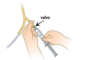 Insertion du bout de la seringue dans la valve de la sonde