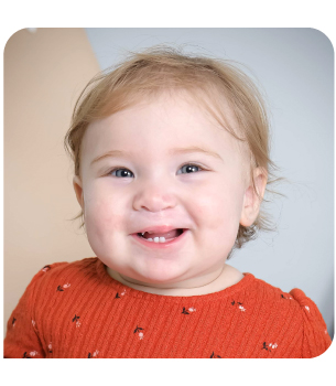 La petite Julia a eu besoin de chirurgies à la lèvre et au palais. Photo de la petite Julia
