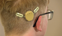 Exemple d'utilisation du "Halo" avec pinces aux cheveux pour Kanso 2 et 3 de Cochlear. Source: Image utilisée avec l'autorisation de Cochlear. Personne portant un Kanso 2 de Cochlear muni d'un accessoire de maintien à deux pinces qui s'attache aux cheveux.