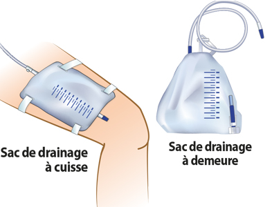 Image des 2 options du sac de drainage.