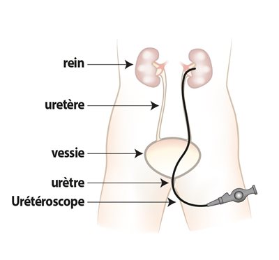 Image du système urinaire.