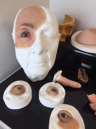 Épithèses réalisées au CHU de Québec-Université Laval.