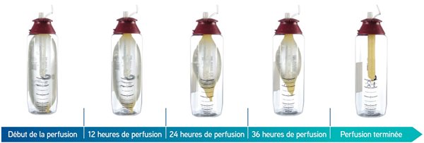 Dégonflement du ballon au fil des heures