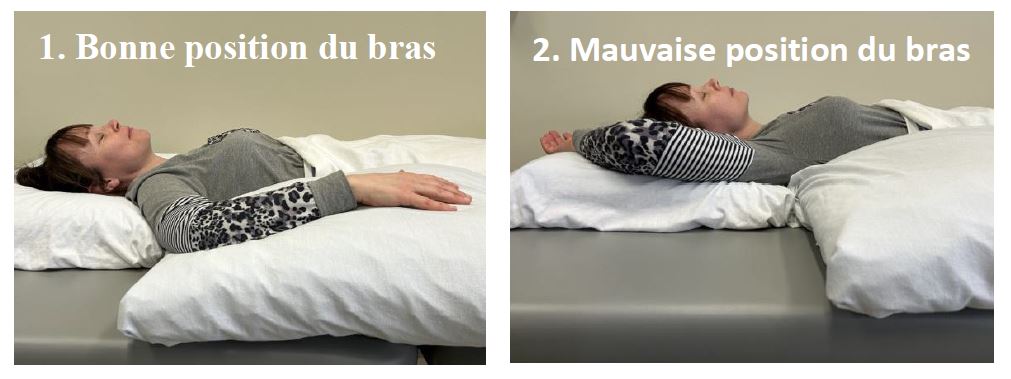 On voit la bonne position du bras lorsqu'on est dans le lit soit de mettre le bras sur le côté du corps au lieu derrière la tête
