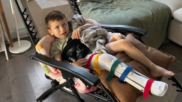 Attelle en orthopédie pédiatrique : les petites avancées qui...